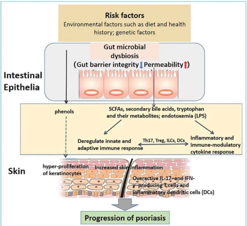 Microbioma-intestinal-en-psoriasis