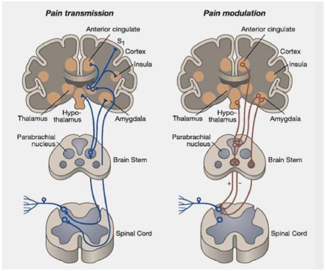 Patogenesis-neuropatia-diabetica