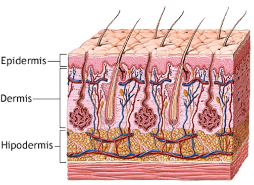 Celulitis de miembros inferiores 2