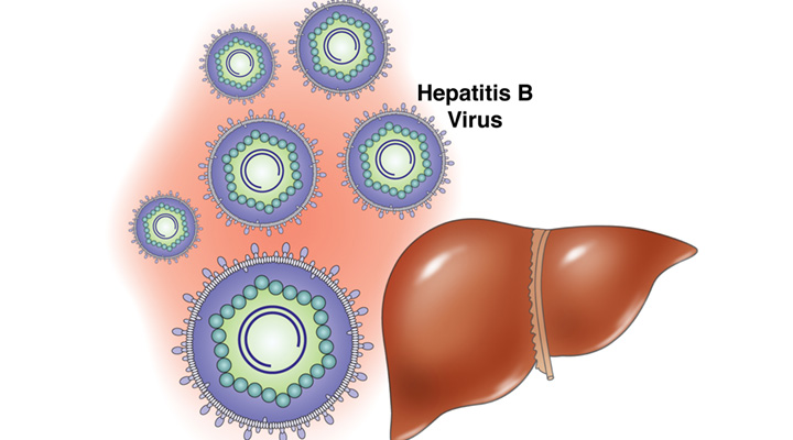 Hepatitis-B-y-artritis-reumatoide3