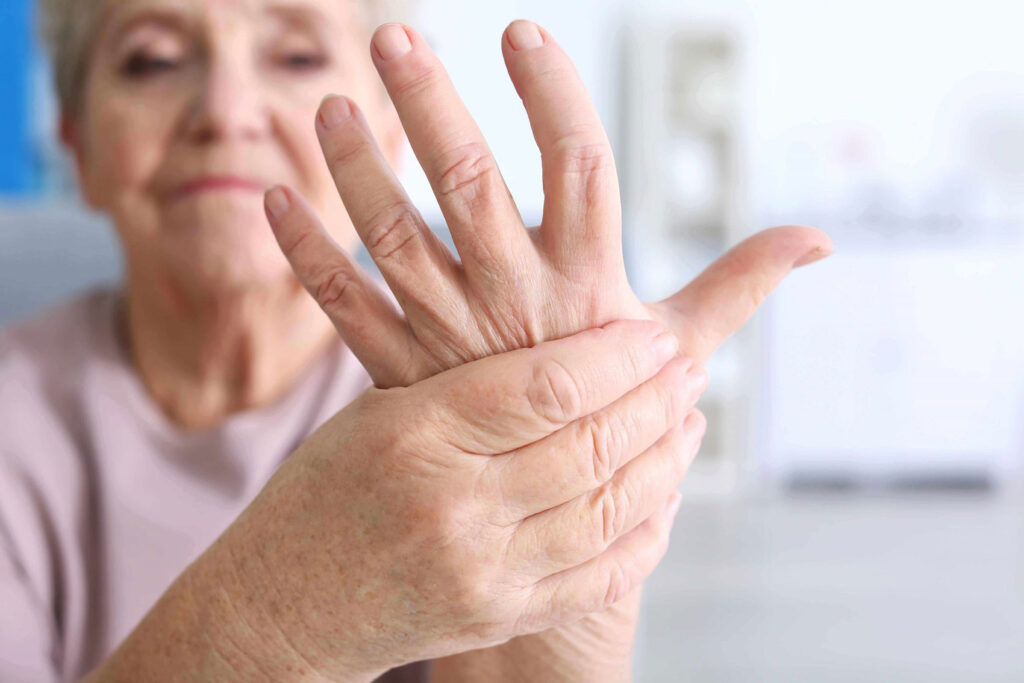 artritis reumatoide 5