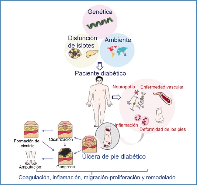 1Pie diabético diagnóstico y tratamiento