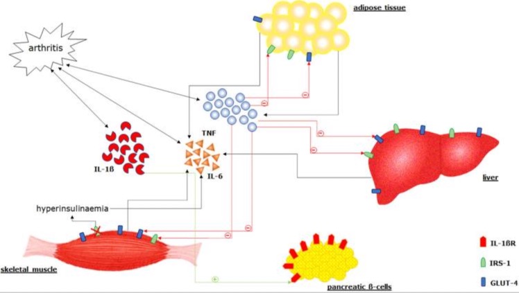 2Artritis reumatoide y diabetes tipo 2