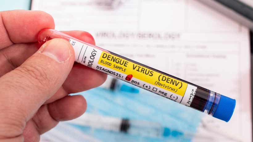 Diabetes y dengue4