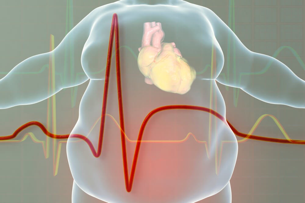 Obesidad, diabetes y enfermedad cardiovascular5