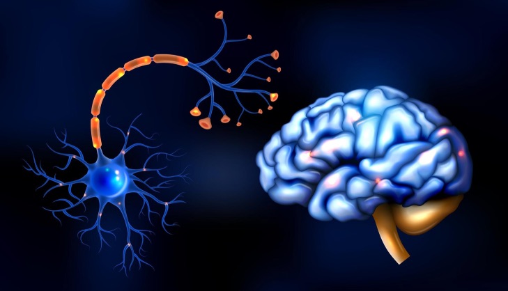 Accidente cerebrovascular factores de riesgo diabetes 2