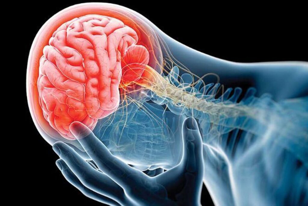 Atención accidente cerebrovascular