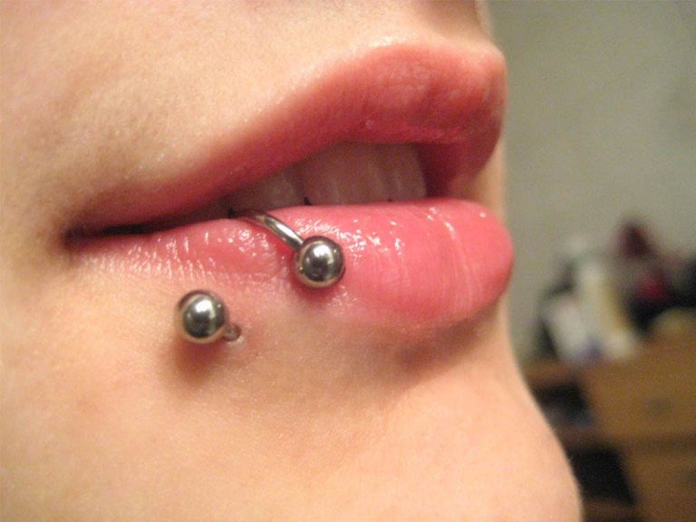 Piercing daños en los dientes1