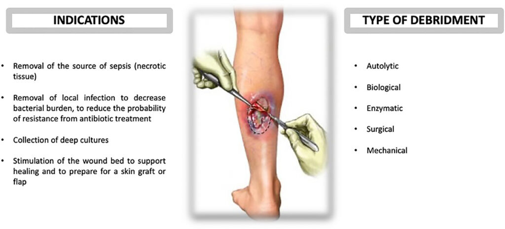 Heridas y desbridamiento enzimático 1