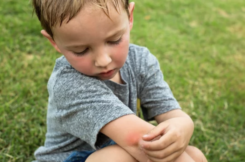 1 Dengue grave en niños