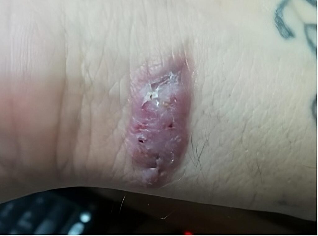 3 Dermatología Argentina 3 2024