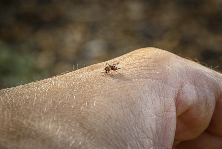 3 Dermatitis atópica dengue