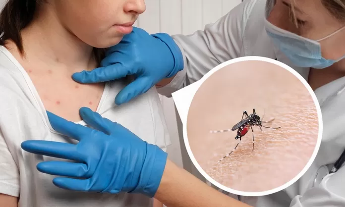 5 Dengue grave en niños