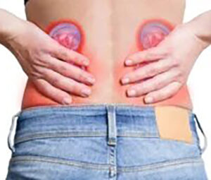 Insuficiencia-renal-aguda4