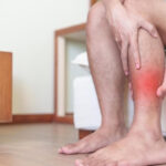 0 Obesidad celulitis