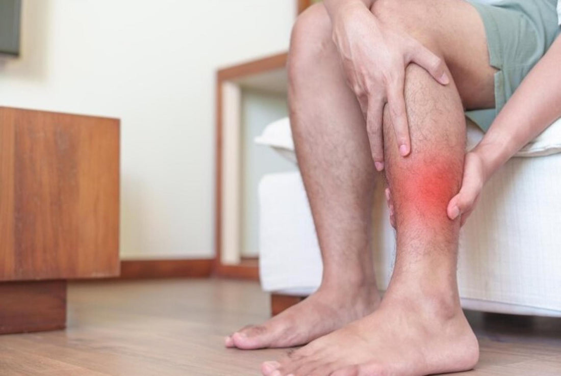 0 Obesidad celulitis