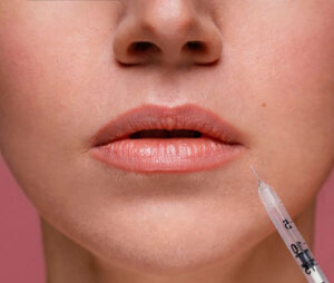 0-Hidroxiapatita-calcio