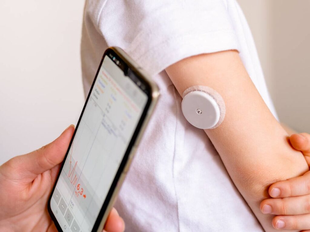 1 Diabetes piel