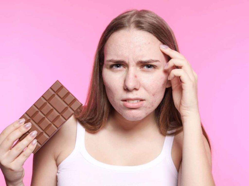 5 Acné nutrición