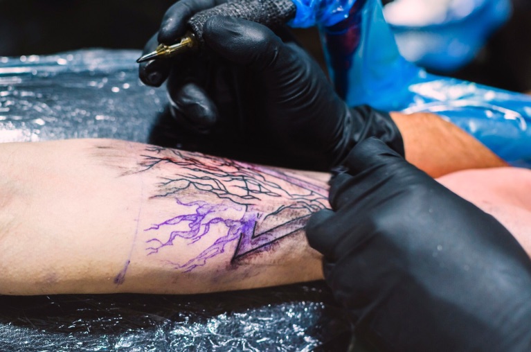 5 Tatuajes melanoma