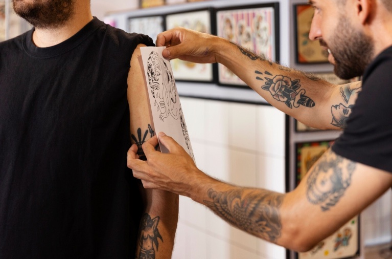 7 Eliminación tatuajes