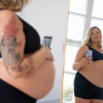 0 Obesidad en el embarazo