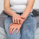 0 Psoriasis riesgo cardiovascular