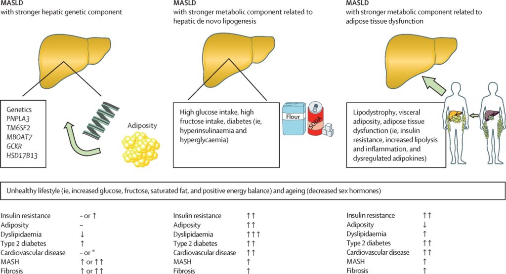3 MASLD y diabetes
