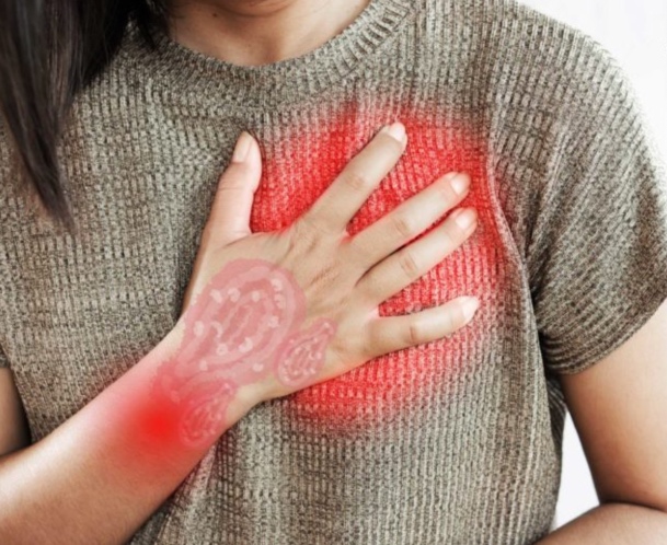 4 Psoriasis riesgo cardiovascular