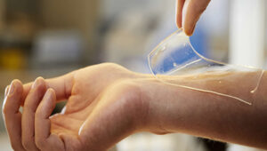 0 Hidrogeles heridas piel