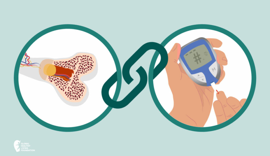 1 Diabetes salud ósea