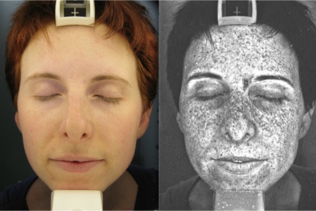 2 Dermatología inteligencia artificial