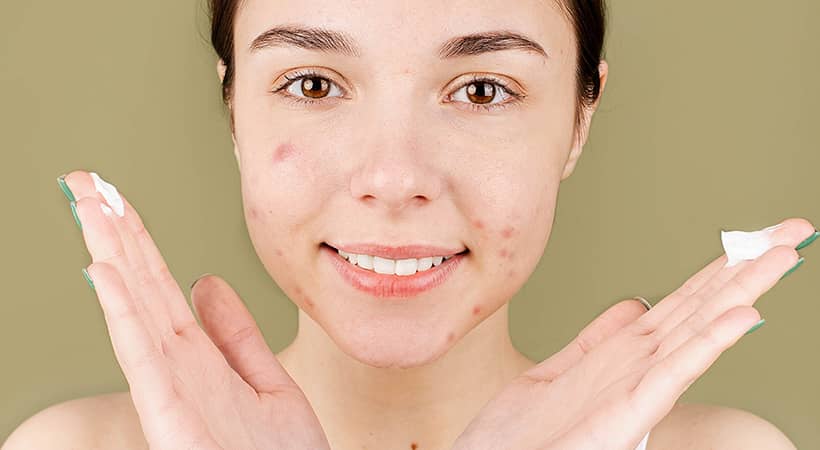 2 Dermocosméticos acné consenso