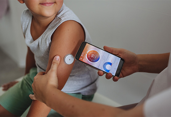 2 monitoreo continuo glucosa pediatría
