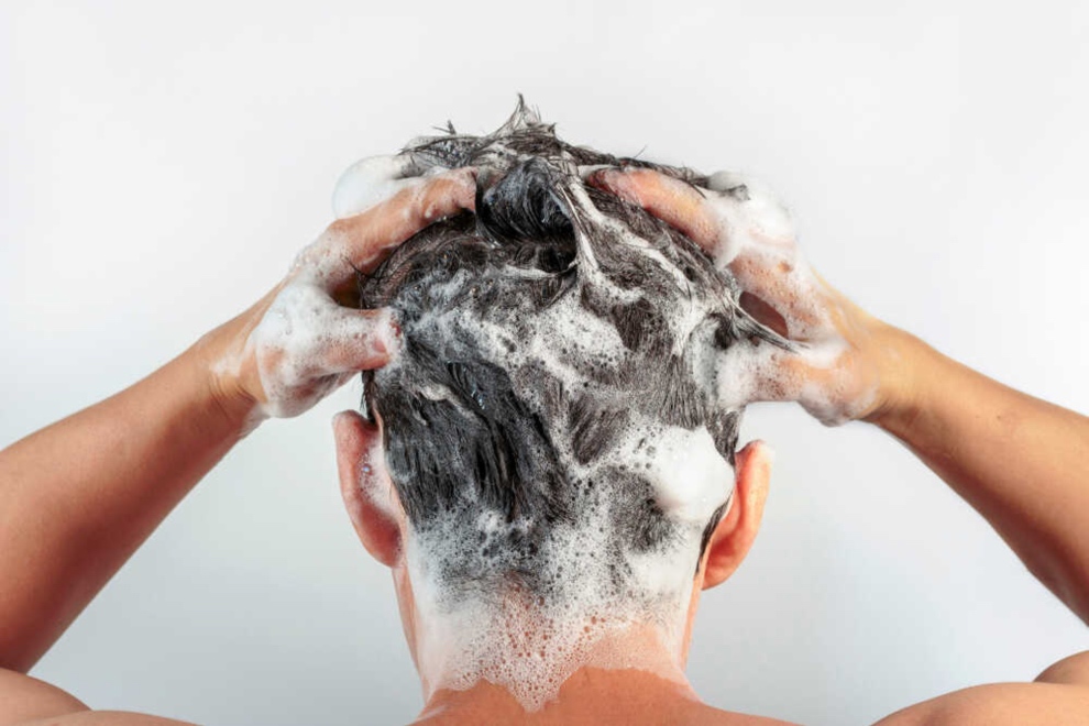 4 Tratamiento dermatitis seborreica