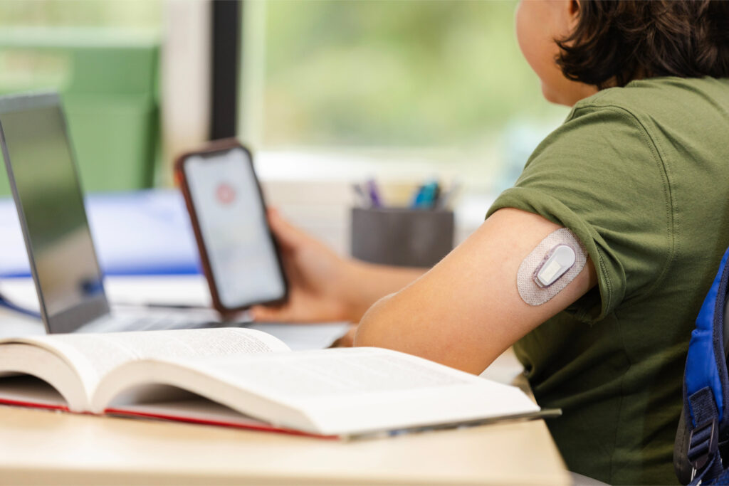 5 monitoreo continuo glucosa pediatría