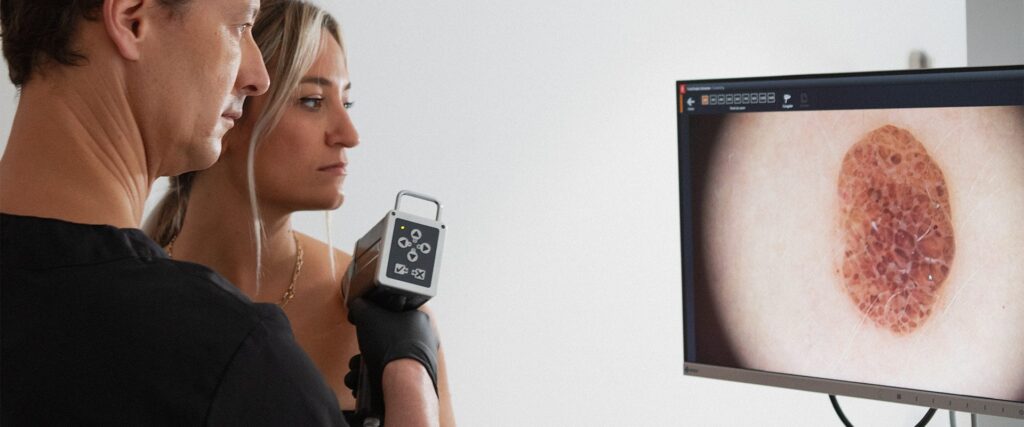 7 Melanoma tecnologías imagen