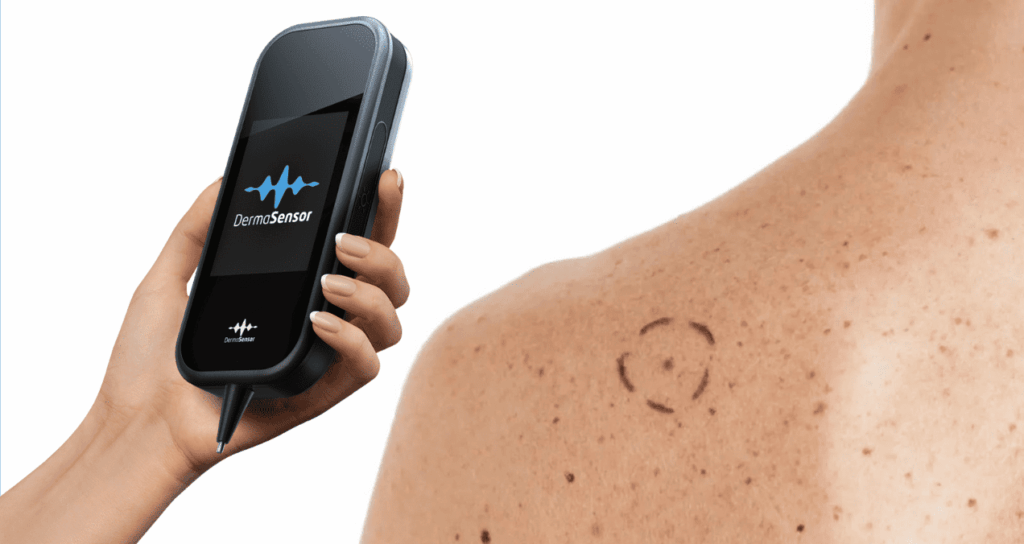 8 Dermatología inteligencia artificial