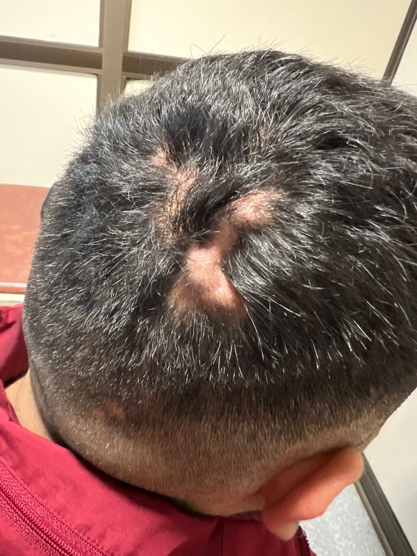 7 Dermatología Argentina 2 2025