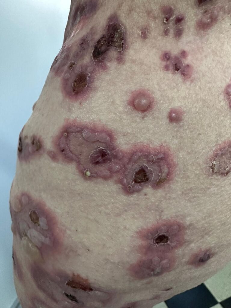 5 Dermatología Argentina 2 2025
