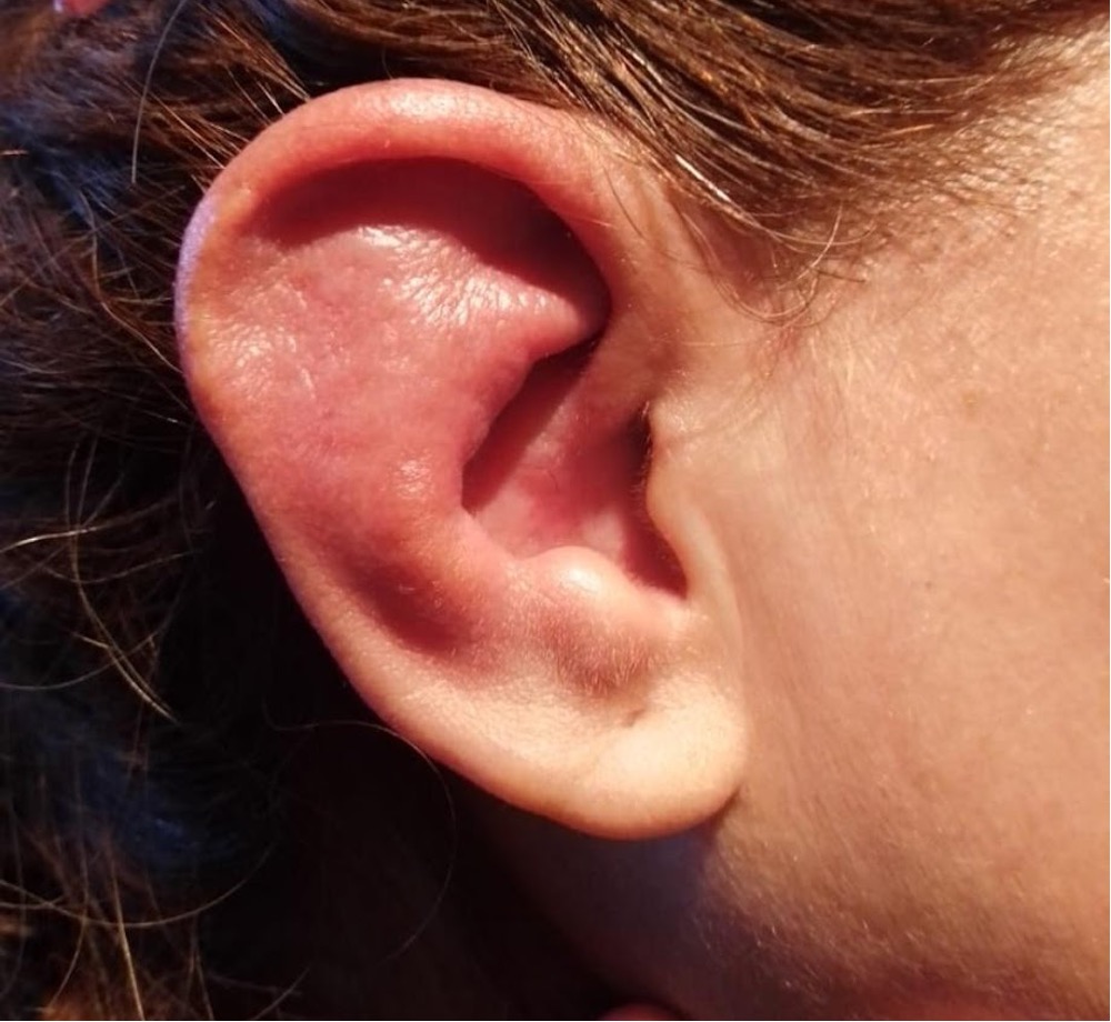 8 Dermatología Argentina 2 2025