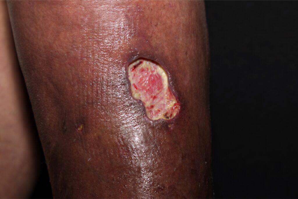6 Dermatología Argentina 2 2025