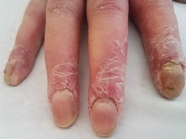 3 Dermatología Argentina 2 2025