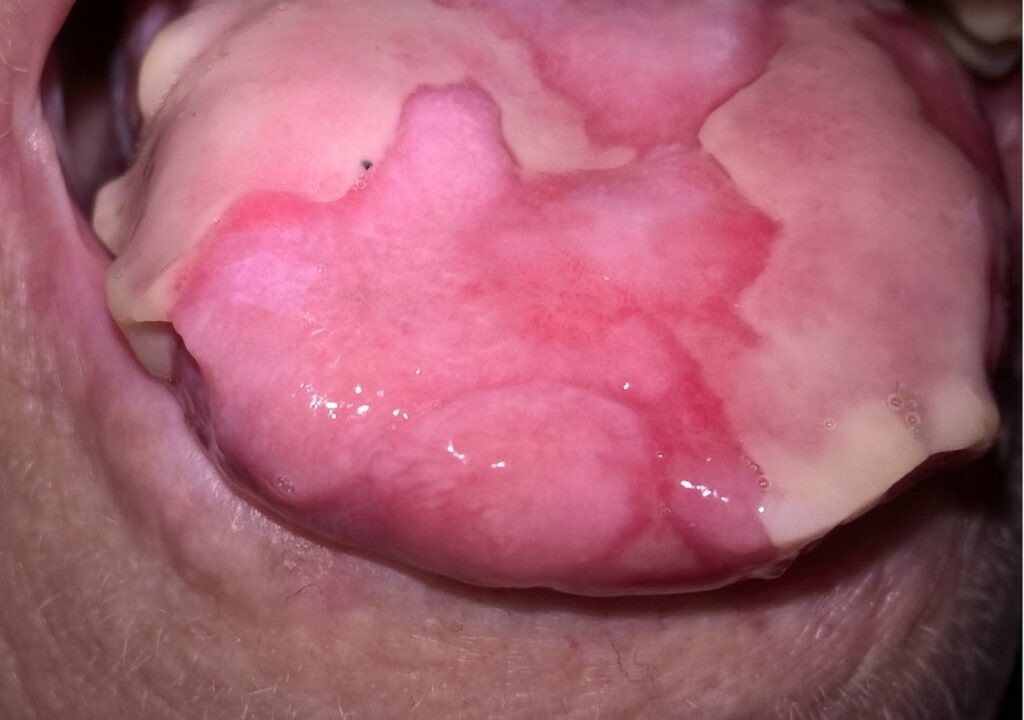 4 Dermatología Argentina 2 2025