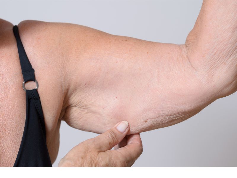 6 Diabetes sarcopenia 
