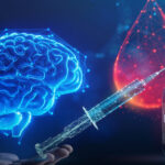 0 Diabetes enfermedad de Alzheimer