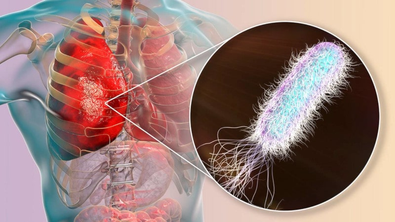1 Diabetes fibrosis quística