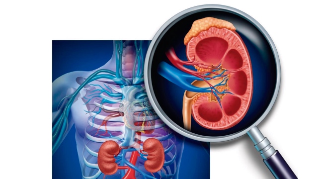 1 Enfermedad renal crónica terapia combinada