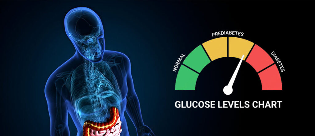 1 Prediabetes monitoreo continuo glucosa