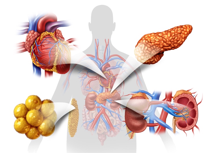 1 Síndrome cardio reno metabólico